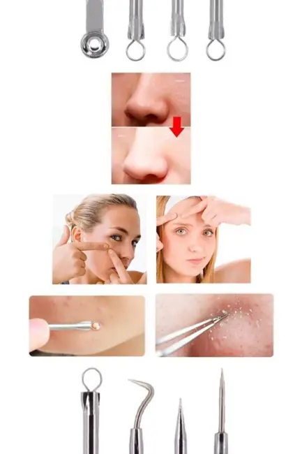 4 Lü Kutulu Paslanmaz Komedon Akne - Siyah Nokta Temizleyici Set