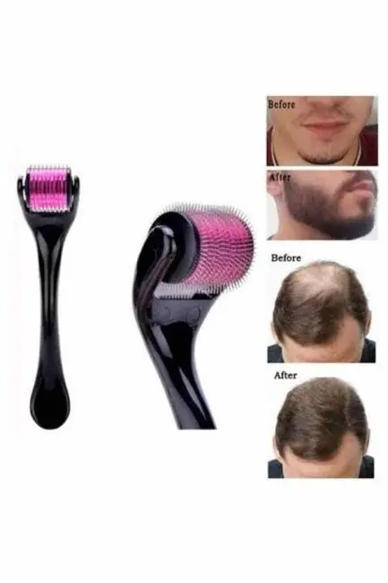 Saç Çıkarma Tarağı Dermaroller 540 Iğneli Roller 1 Mm Iğne Cilt Yüz Yenileme Bakım Seti