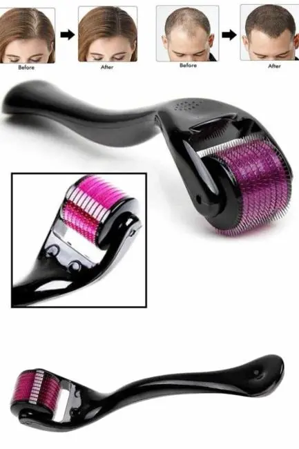 Derma Roller Titanyum Uçlu 540 İğneli 1 Mm Saç Sakal Çıkarma Ve Cilt Bakım Masaj Aleti