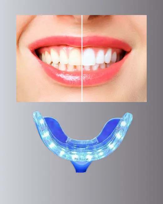 LED Işıklı Profesyonel Diş Beyazlatma Seti